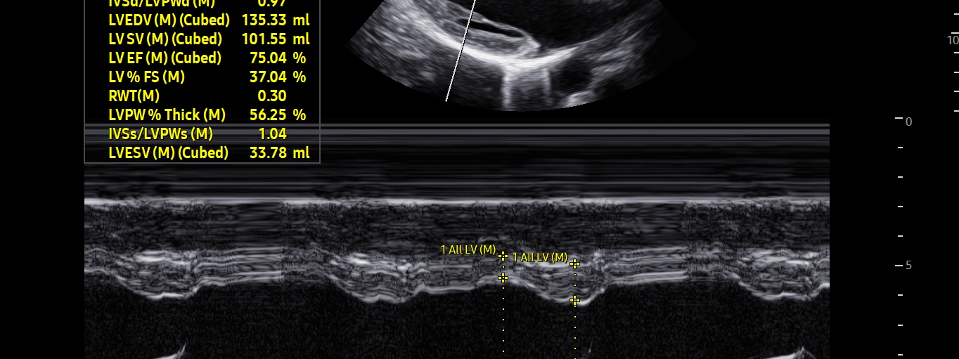 Learning from the masters: Preeclampsia and Ultrasound