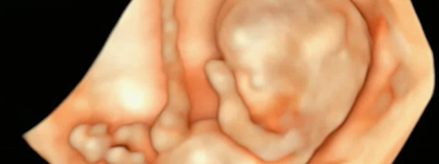 Early pregnancy care – what can we learn from the masters?